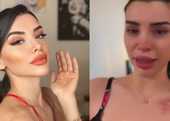 Aleyna Eroğlu ünlü futbolcudan şiddet gördüğünü belirtti