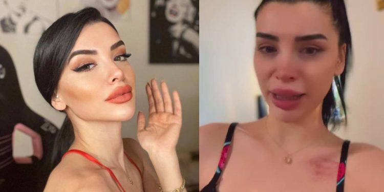 Aleyna Eroğlu ünlü futbolcudan şiddet gördüğünü belirtti